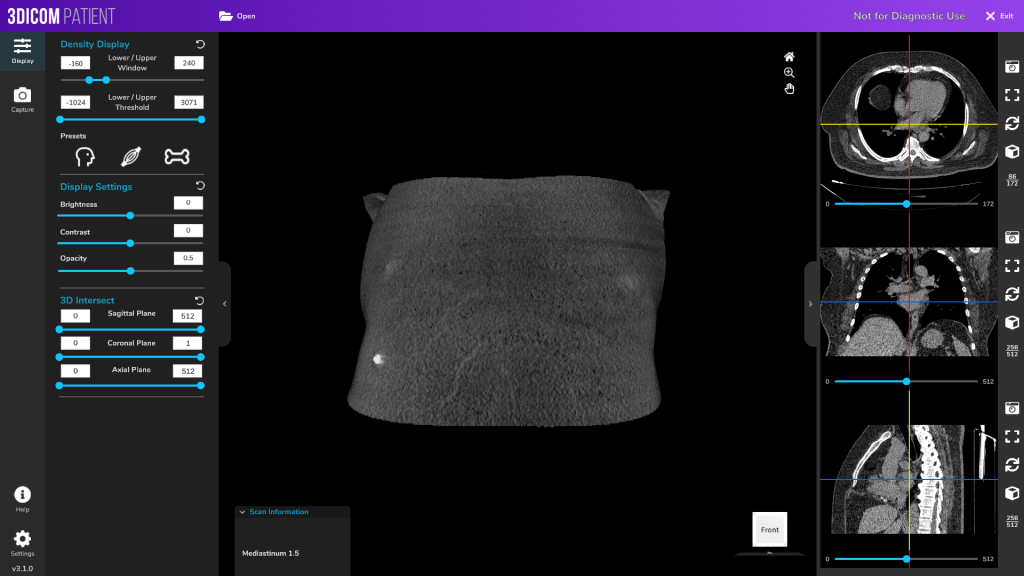 Dicom viewer